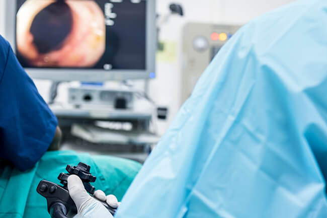 日帰り大腸ポリープ切除術